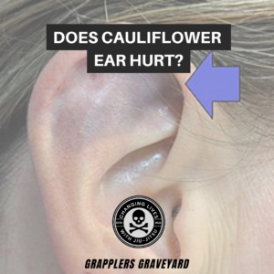 does cauliflower ear hurt