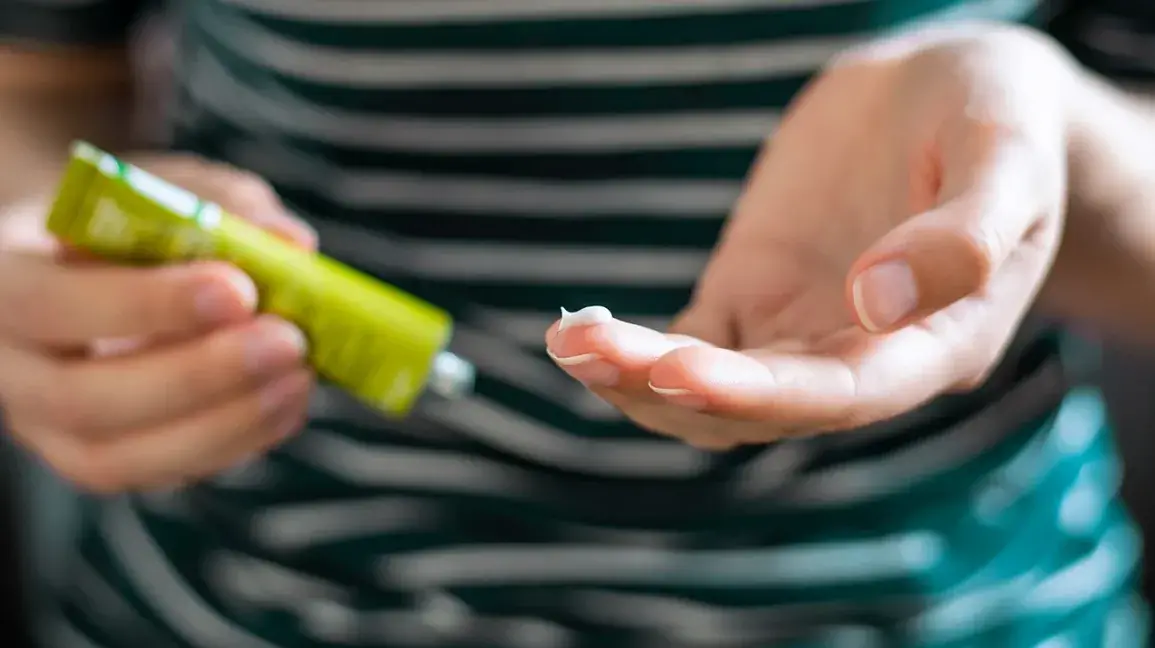 hwo to treat ringwrom